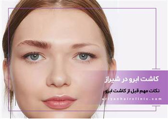 نکات مهم قبل از کاشت ابرو